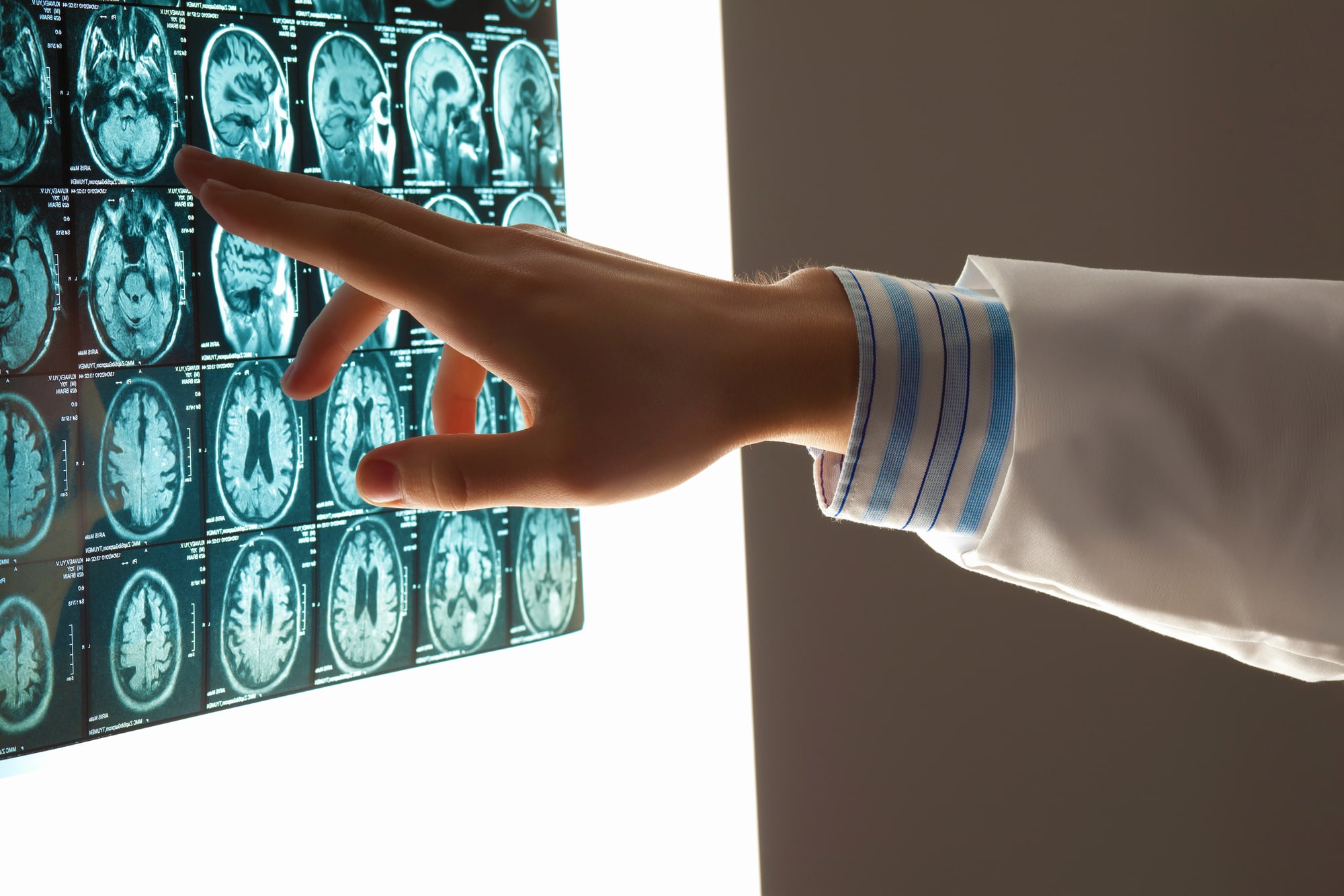 brain injury attorney in Oklahoma City, OK