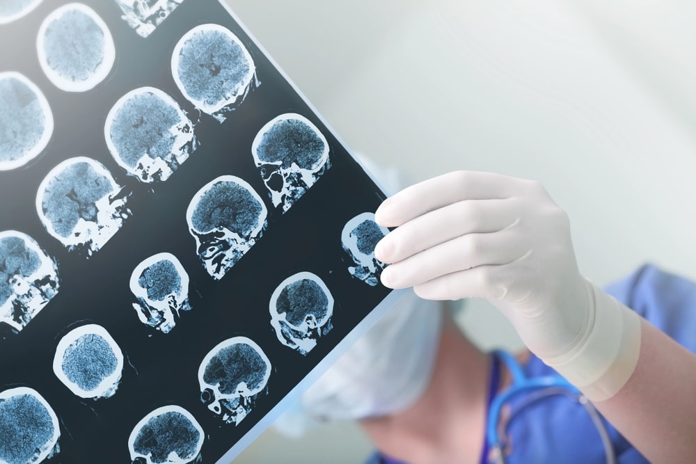 Brain Injury Lawyer In Oklahoma