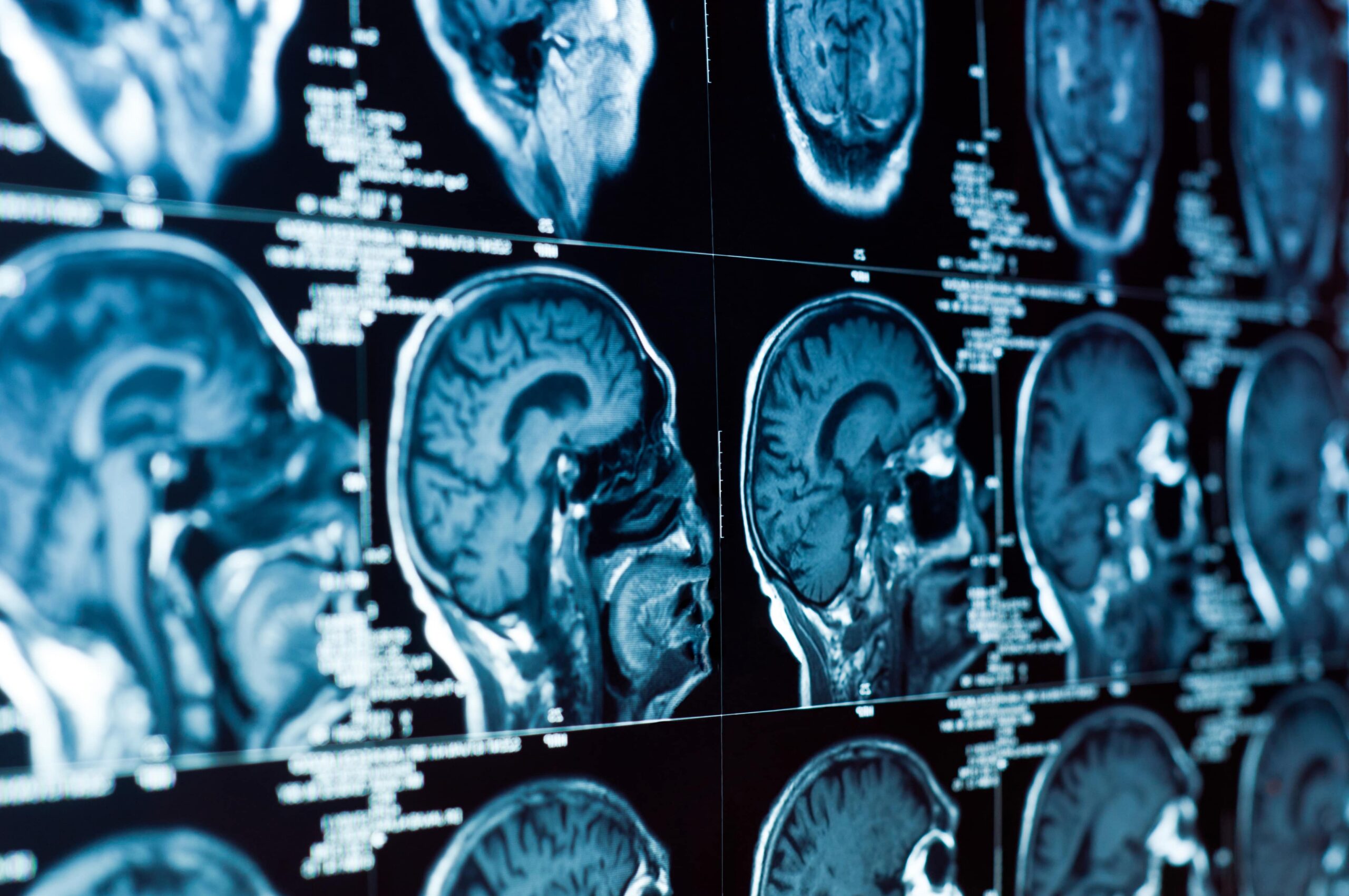 brain injury lawyer Norman, OK